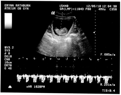Ultrasound 6Dec2010a